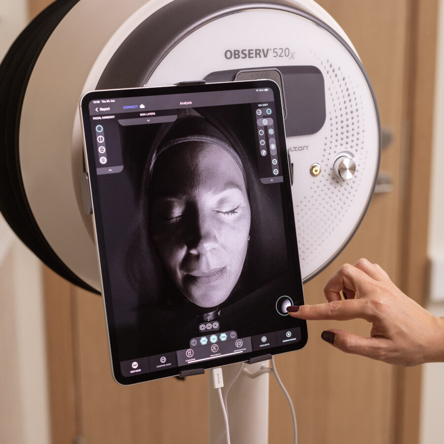 OBSERV 520x näonaha analüüs