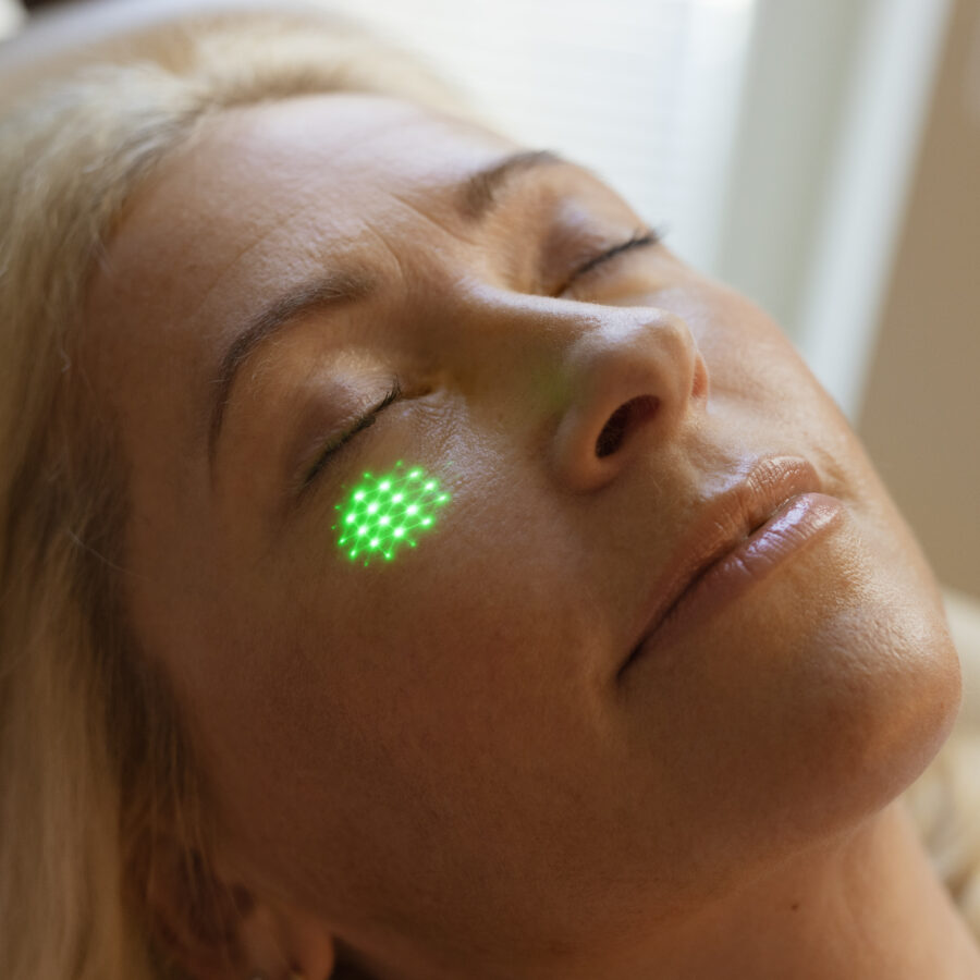 Fotona Timewalker laserprotseduurid